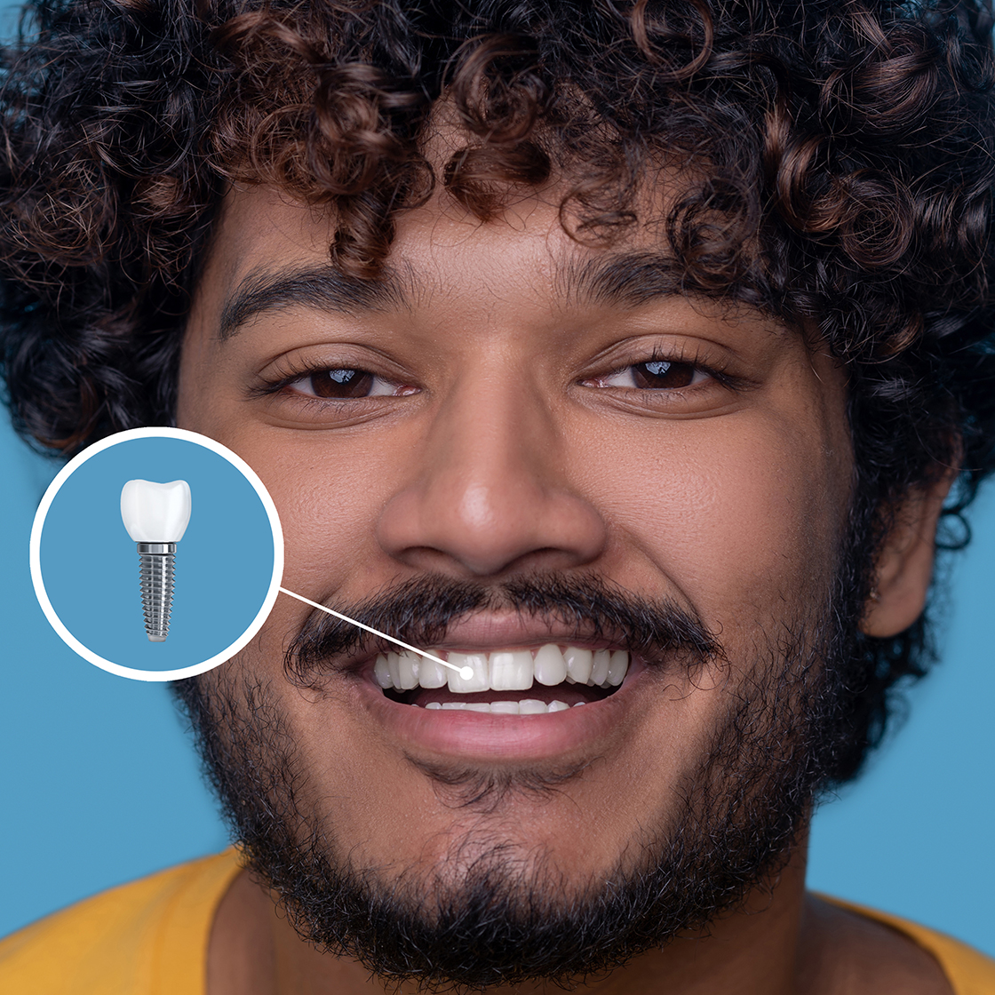 Man smiling with Dental Implants