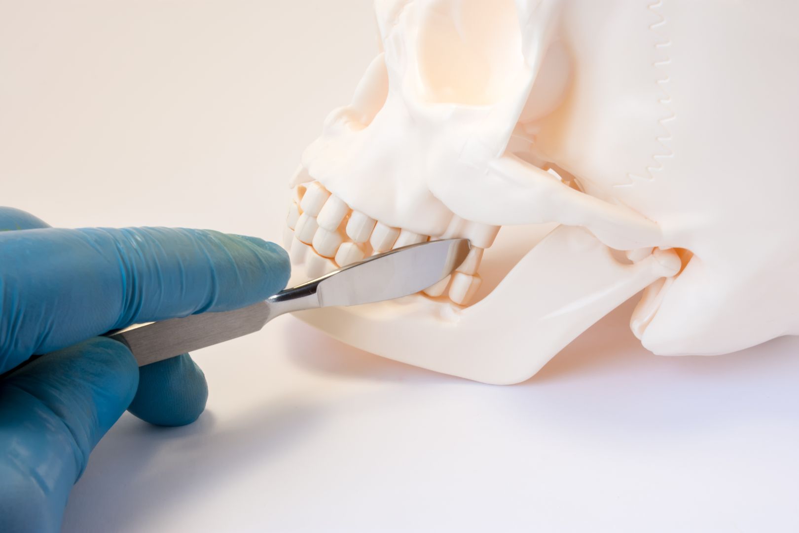 corrective jaw surgery