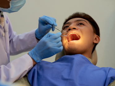 Dental Extractions